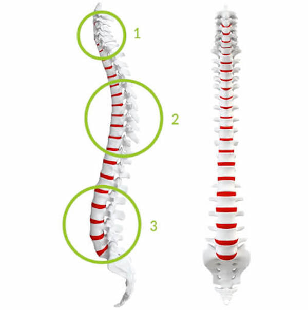 Fix Your Golfing Back Pain - Step 2: Early Stage Rehab